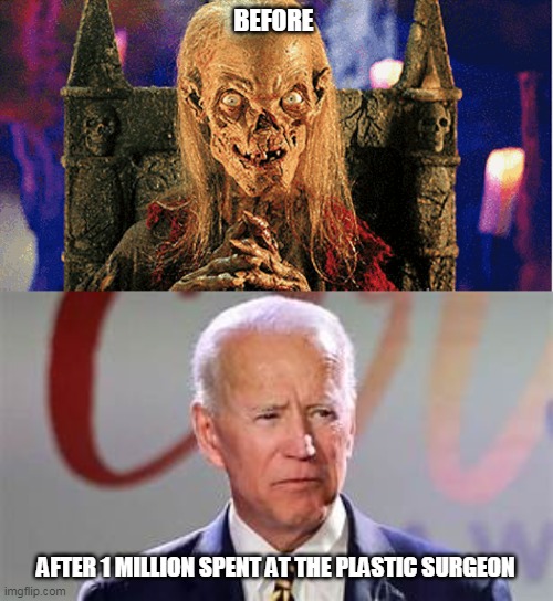 Joe Biden Plastic surgery | BEFORE; AFTER 1 MILLION SPENT AT THE PLASTIC SURGEON | image tagged in political meme | made w/ Imgflip meme maker