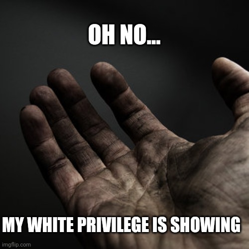 Dirty hands | OH NO... MY WHITE PRIVILEGE IS SHOWING | image tagged in dirty hands | made w/ Imgflip meme maker