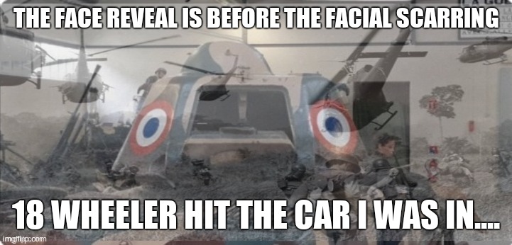 French Tank PTSD | THE FACE REVEAL IS BEFORE THE FACIAL SCARRING; 18 WHEELER HIT THE CAR I WAS IN.... | image tagged in french tank ptsd | made w/ Imgflip meme maker