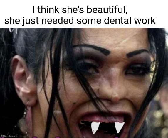 I think she's beautiful, she just needed some dental work | made w/ Imgflip meme maker
