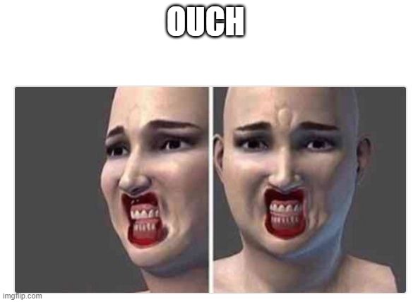 Ouch | OUCH | image tagged in ouch | made w/ Imgflip meme maker