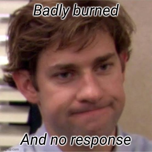 Badly burned And no response | made w/ Imgflip meme maker