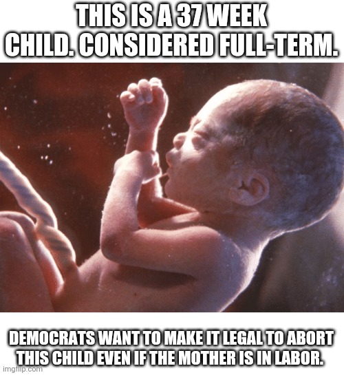 THIS IS A 37 WEEK CHILD. CONSIDERED FULL-TERM. DEMOCRATS WANT TO MAKE IT LEGAL TO ABORT THIS CHILD EVEN IF THE MOTHER IS IN LABOR. | image tagged in children,infant,pro life | made w/ Imgflip meme maker