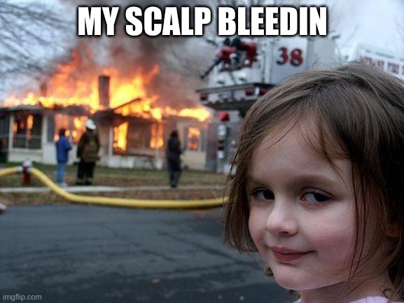 Disaster Girl Meme | MY SCALP BLEEDIN | image tagged in memes,disaster girl | made w/ Imgflip meme maker