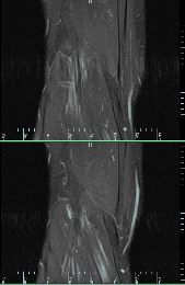 image tagged in gifs | made w/ Imgflip images-to-gif maker