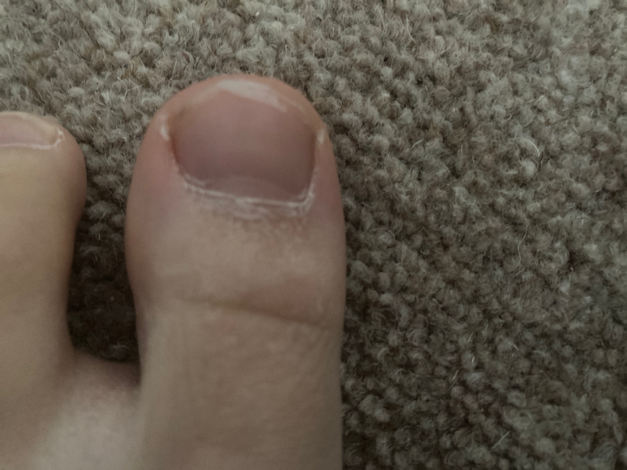 Toe Blank Meme Template