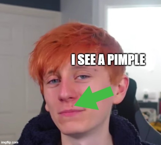 I SEE A PIMPLE | made w/ Imgflip meme maker