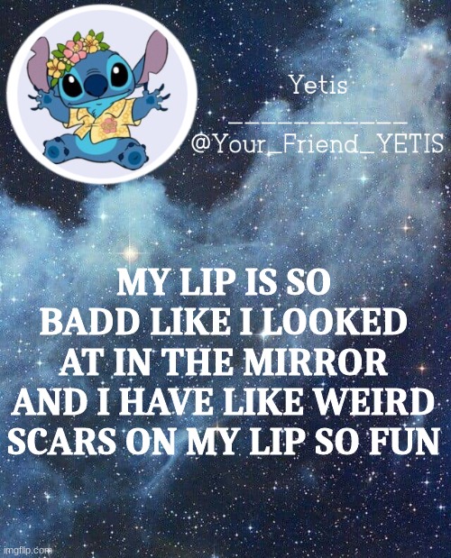 SCREEEEEEEEE | MY LIP IS SO BADD LIKE I LOOKED AT IN THE MIRROR AND I HAVE LIKE WEIRD SCARS ON MY LIP SO FUN | image tagged in yetis and stich | made w/ Imgflip meme maker