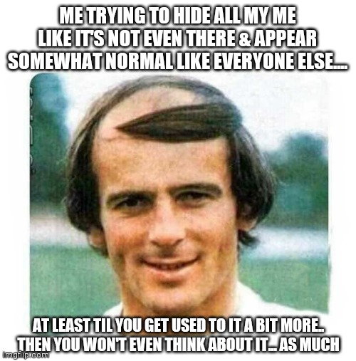 ME TRYING TO HIDE ALL MY ME LIKE IT'S NOT EVEN THERE & APPEAR SOMEWHAT NORMAL LIKE EVERYONE ELSE.... AT LEAST TIL YOU GET USED TO IT A BIT MORE..
THEN YOU WON'T EVEN THINK ABOUT IT... AS MUCH | image tagged in baldness,memes,cover up,funny,just act normal,black sheep | made w/ Imgflip meme maker