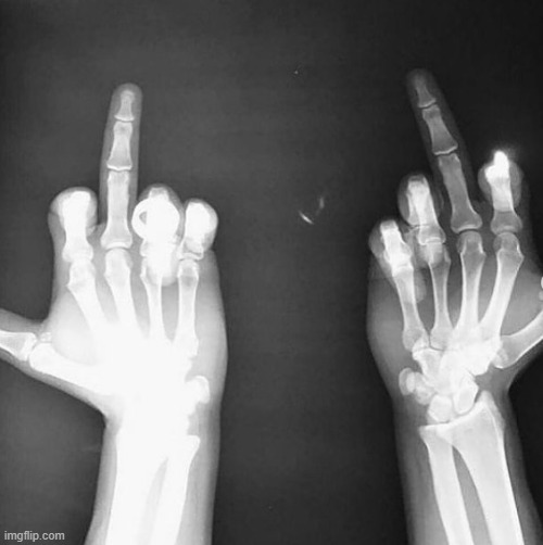 This is precisely, a skeletal flip off. To flip you off. | image tagged in skeleton | made w/ Imgflip meme maker