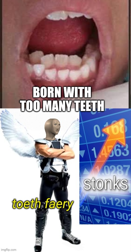 Toothy Stonks | BORN WITH TOO MANY TEETH | image tagged in stonks,meme man,tooth fairy | made w/ Imgflip meme maker