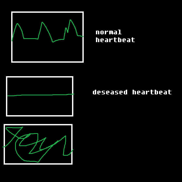 High Quality heartbeat but remade Blank Meme Template
