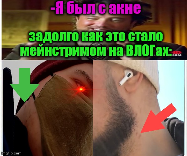 -Carry lines for order. | -Я был с акне; задолго как это стало мейнстримом на ВЛОГах: | image tagged in russians,acne,face,pretty,it's enough to make a grown man cry,youtubers | made w/ Imgflip meme maker
