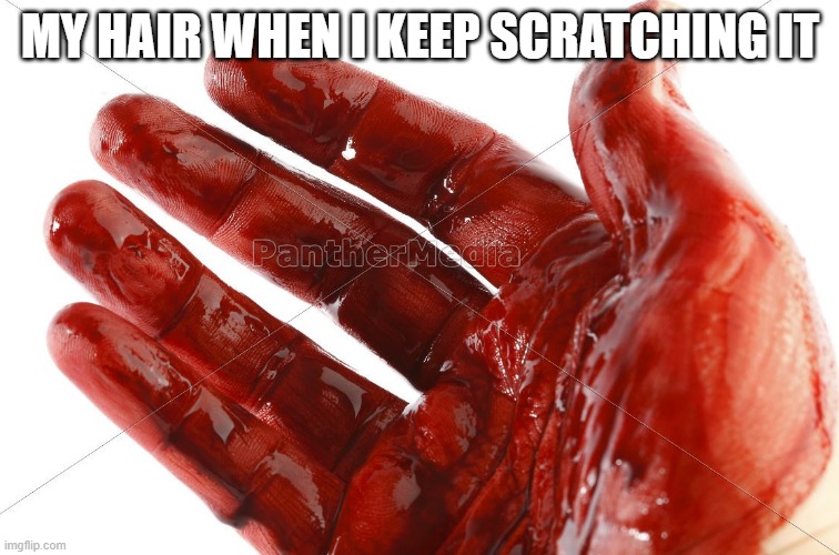Blood in hair | MY HAIR WHEN I KEEP SCRATCHING IT | image tagged in hand pain,blood | made w/ Imgflip meme maker