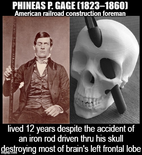 From this accident Drs discovered how certain areas of brain work | PHINEAS P. GAGE (1823–1860); American railroad construction foreman; lived 12 years despite the accident of
an iron rod driven thru his skull
destroying most of brain's left frontal lobe | image tagged in vince vance,skull,brain,crowbar,science,memes | made w/ Imgflip meme maker