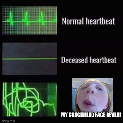 heartbeat rate | MY CRACKHEAD FACE REVEAL | image tagged in heartbeat rate | made w/ Imgflip meme maker