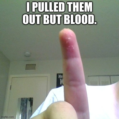 I pulled them out. | I PULLED THEM OUT BUT BLOOD. | image tagged in ouch,hurt,finger | made w/ Imgflip meme maker