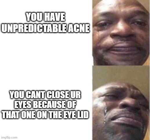 Black Guy Crying | YOU HAVE UNPREDICTABLE ACNE; YOU CANT CLOSE UR EYES BECAUSE OF THAT ONE ON THE EYE LID | image tagged in black guy crying | made w/ Imgflip meme maker