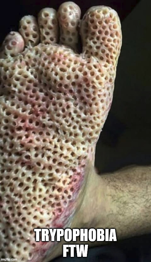 Do you have this phobia? | TRYPOPHOBIA FTW | image tagged in trypophobia,phobia,feet,medical condition | made w/ Imgflip meme maker