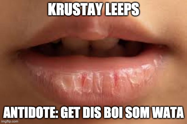 KRUSTAY LEEPS; ANTIDOTE: GET DIS BOI SOM WATA | made w/ Imgflip meme maker