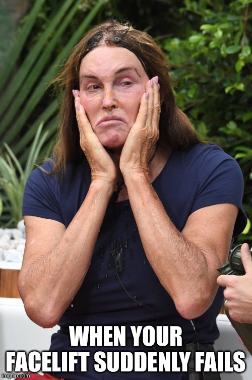 Caitlyn Jenner | WHEN YOUR FACELIFT SUDDENLY FAILS | image tagged in lj herr | made w/ Imgflip meme maker