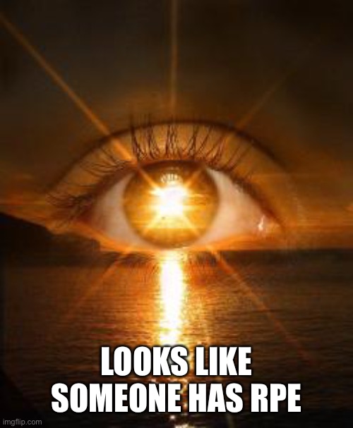 Must be from all the time looking into the sun | LOOKS LIKE SOMEONE HAS RPE | image tagged in rpe | made w/ Imgflip meme maker