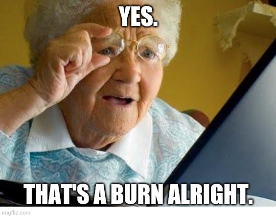 Yep, that's a burn. |  YES. THAT'S A BURN ALRIGHT. | image tagged in old lady at computer,burn,apply cold water to burned area,burned | made w/ Imgflip meme maker