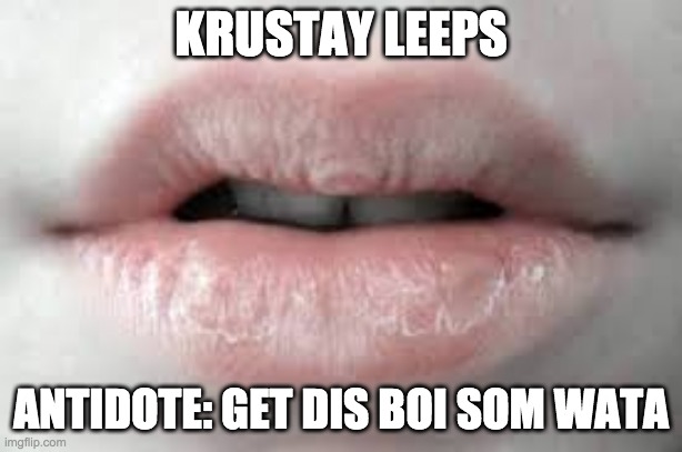 KRUSTAY LEEPS; ANTIDOTE: GET DIS BOI SOM WATA | made w/ Imgflip meme maker