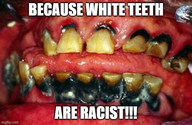 Racist! | BECAUSE WHITE TEETH; ARE RACIST!!! | image tagged in rotten teeth | made w/ Imgflip meme maker