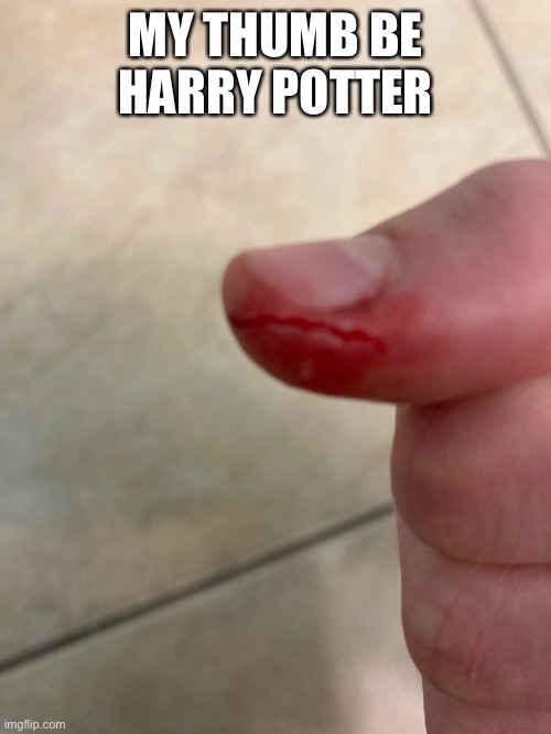 Weeee | MY THUMB BE HARRY POTTER | made w/ Imgflip meme maker