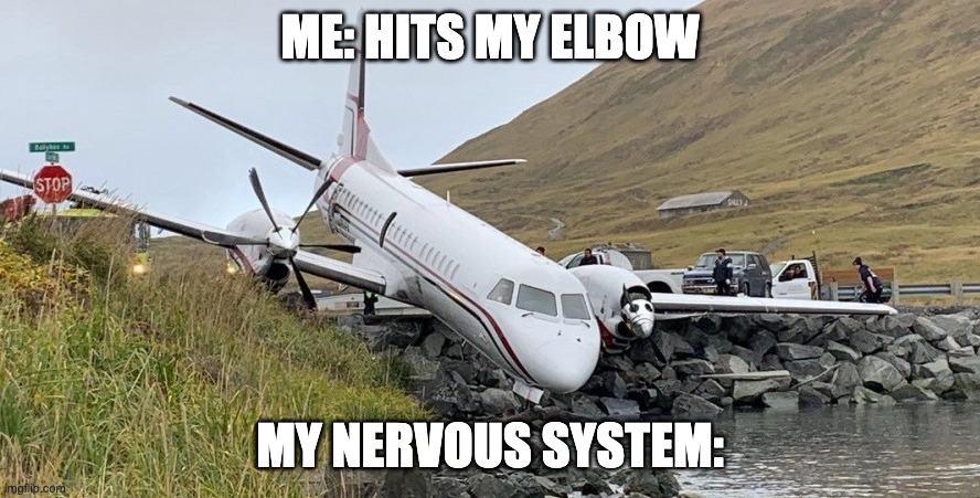 when you bang your elbow | ME: HITS MY ELBOW; MY NERVOUS SYSTEM: | image tagged in memes | made w/ Imgflip meme maker