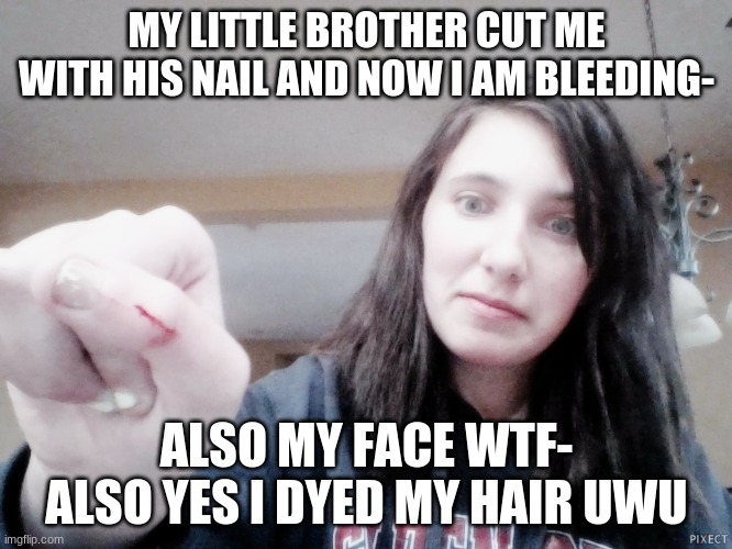 Lmao- | MY LITTLE BROTHER CUT ME WITH HIS NAIL AND NOW I AM BLEEDING-; ALSO MY FACE WTF-
ALSO YES I DYED MY HAIR UWU | image tagged in i am bleeding,tragic,you should feel bad for me,haha | made w/ Imgflip meme maker