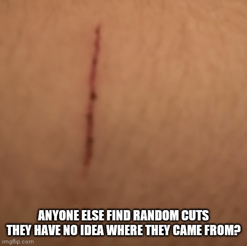 This was possibly my cat | ANYONE ELSE FIND RANDOM CUTS THEY HAVE NO IDEA WHERE THEY CAME FROM? | made w/ Imgflip meme maker