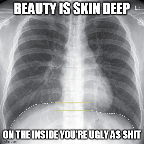 beauty | BEAUTY IS SKIN DEEP; ON THE INSIDE YOU'RE UGLY AS SHIT | image tagged in beauty | made w/ Imgflip meme maker