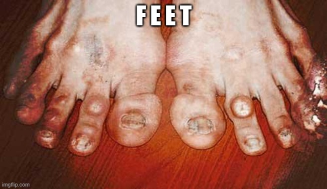 Ugly Feet | F E E T | image tagged in ugly feet | made w/ Imgflip meme maker