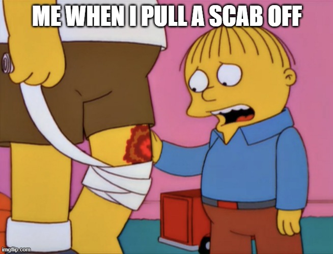 Why does it always mass bleed in some way | ME WHEN I PULL A SCAB OFF | image tagged in it knows you re afraid,blood,scab | made w/ Imgflip meme maker