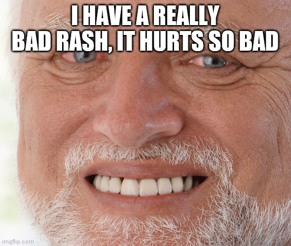 I've had it for a bit over a year | I HAVE A REALLY BAD RASH, IT HURTS SO BAD | image tagged in hide the pain harold | made w/ Imgflip meme maker