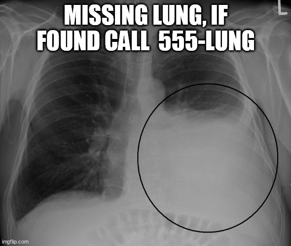 Missing | MISSING LUNG, IF FOUND CALL  555-LUNG | image tagged in missing | made w/ Imgflip meme maker