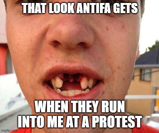 50% off dental work for antifa | THAT LOOK ANTIFA GETS; WHEN THEY RUN INTO ME AT A PROTEST | image tagged in antifa,knockout,stupid liberals,truth,funny memes | made w/ Imgflip meme maker