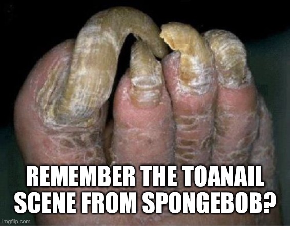 Toenails | REMEMBER THE TOANAIL SCENE FROM SPONGEBOB? | image tagged in toenails | made w/ Imgflip meme maker