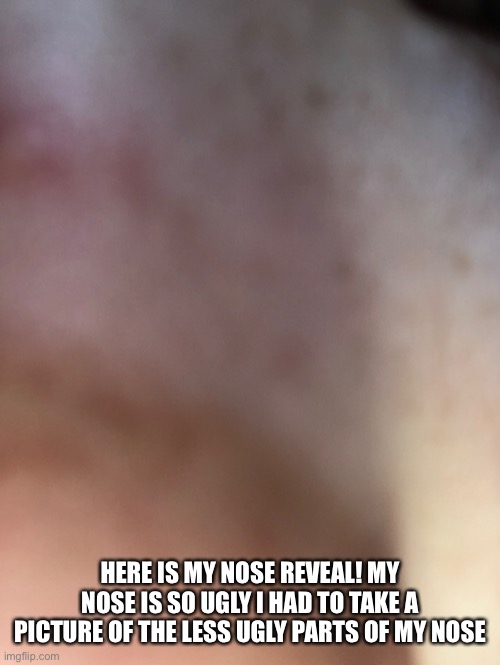 HERE IS MY NOSE REVEAL! MY NOSE IS SO UGLY I HAD TO TAKE A PICTURE OF THE LESS UGLY PARTS OF MY NOSE | image tagged in nose | made w/ Imgflip meme maker