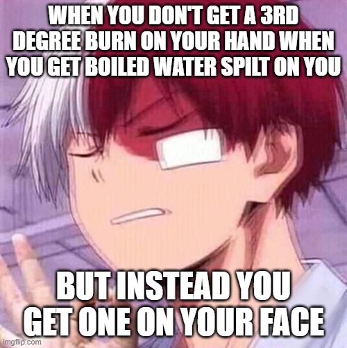 Todoroki | WHEN YOU DON'T GET A 3RD DEGREE BURN ON YOUR HAND WHEN YOU GET BOILED WATER SPILT ON YOU; BUT INSTEAD YOU GET ONE ON YOUR FACE | image tagged in todoroki | made w/ Imgflip meme maker