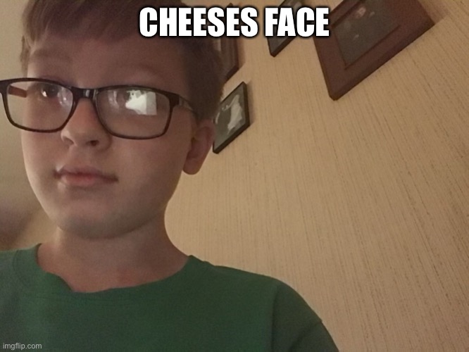 PROOF IM NOT DALTOIDS ICEU | CHEESES FACE | image tagged in my face | made w/ Imgflip meme maker