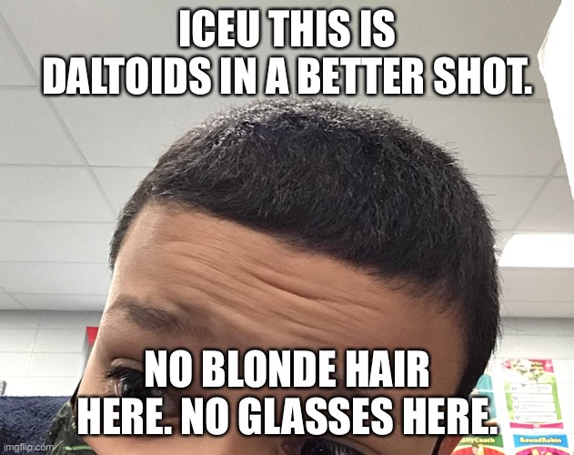 STOP | ICEU THIS IS DALTOIDS IN A BETTER SHOT. NO BLONDE HAIR HERE. NO GLASSES HERE. | image tagged in aaaaa | made w/ Imgflip meme maker
