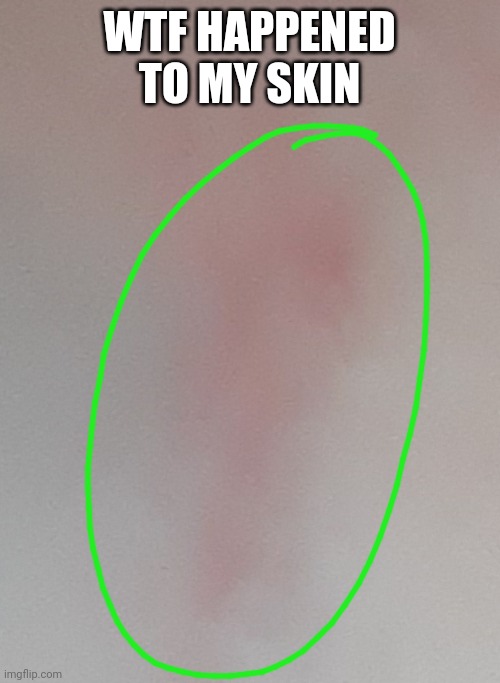 WTF HAPPENED TO MY SKIN | made w/ Imgflip meme maker