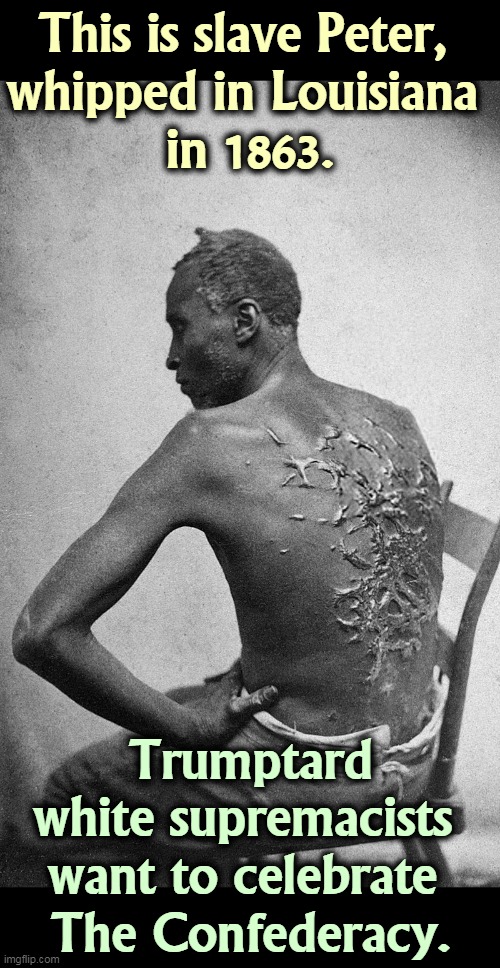 America's Eternal Shame. Only bottom-of-the-barrel whites think this was a good thing. | This is slave Peter, 
whipped in Louisiana 
in 1863. Trumptard white supremacists 
want to celebrate 
The Confederacy. | image tagged in slavery,white supremacists,rednecks,neo-nazis,confederacy,whipped | made w/ Imgflip meme maker