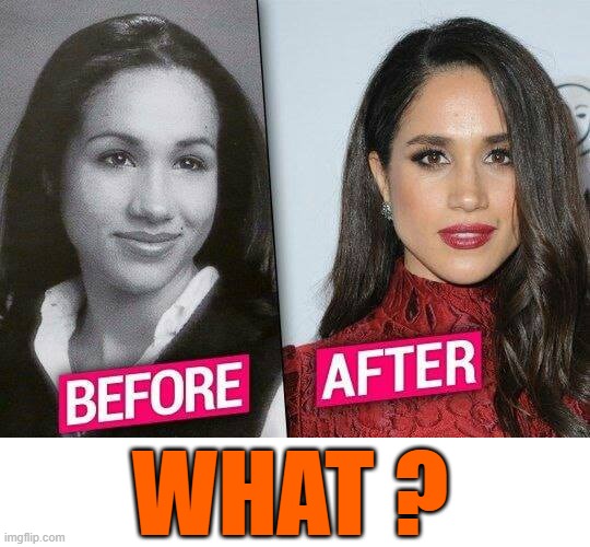 Before and After - WHAT ? | WHAT ? | image tagged in meghan markle | made w/ Imgflip meme maker