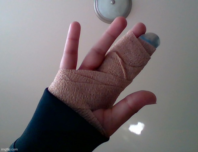 fractured my finger, wont be able to draw for 6-8 weeks qwq- | made w/ Imgflip meme maker