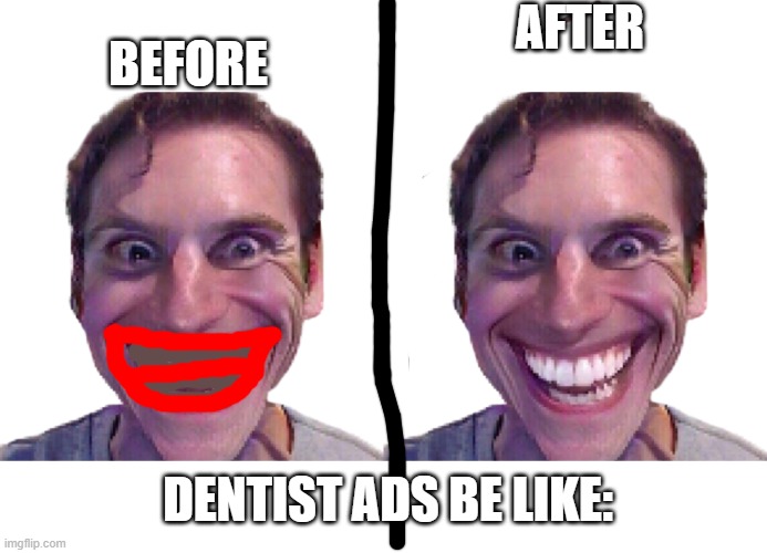 Dentist ads be like: | AFTER; BEFORE; DENTIST ADS BE LIKE: | image tagged in when the impostor is sus,dentist,ads,be like | made w/ Imgflip meme maker