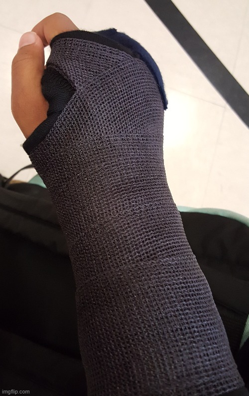 got  a  cast | image tagged in lol | made w/ Imgflip meme maker